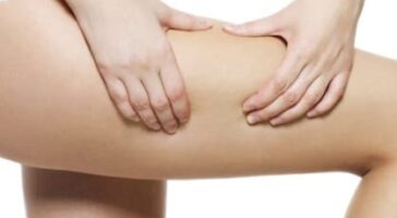 How to Get Rid of the Cellulite